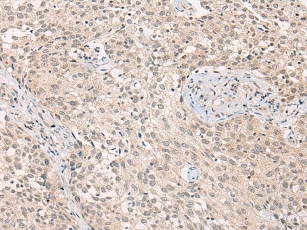 Anti-ADORA1 Antibody