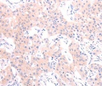 Anti-HCRT Antibody