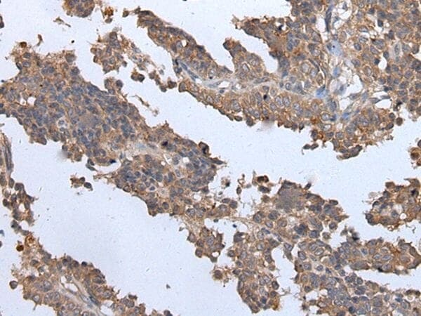 Anti-ENPP2 Antibody