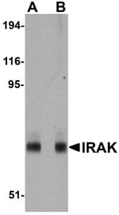 Anti-IRAK Antibody