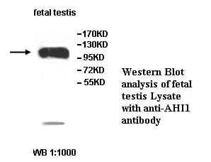 Anti-AHI1 Antibody