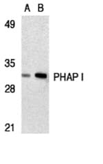 Anti-PHAP I Antibody