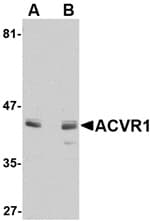 Anti-ACVR1 Antibody