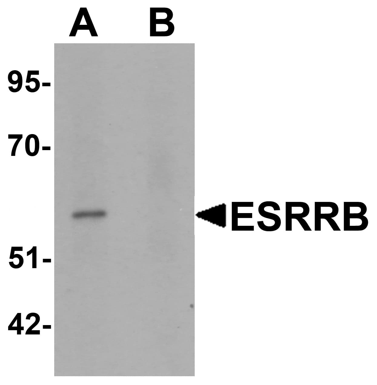 Anti-ESRRB Antibody