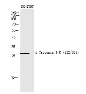 Anti-Troponin I-C (Phospho-Ser22 / Ser23) Antibody