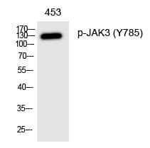 Anti-JAK3 (Phospho-Tyr785) Antibody