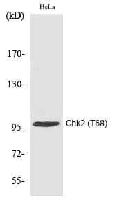 Anti-Chk2 (Phospho-Thr68) Antibody