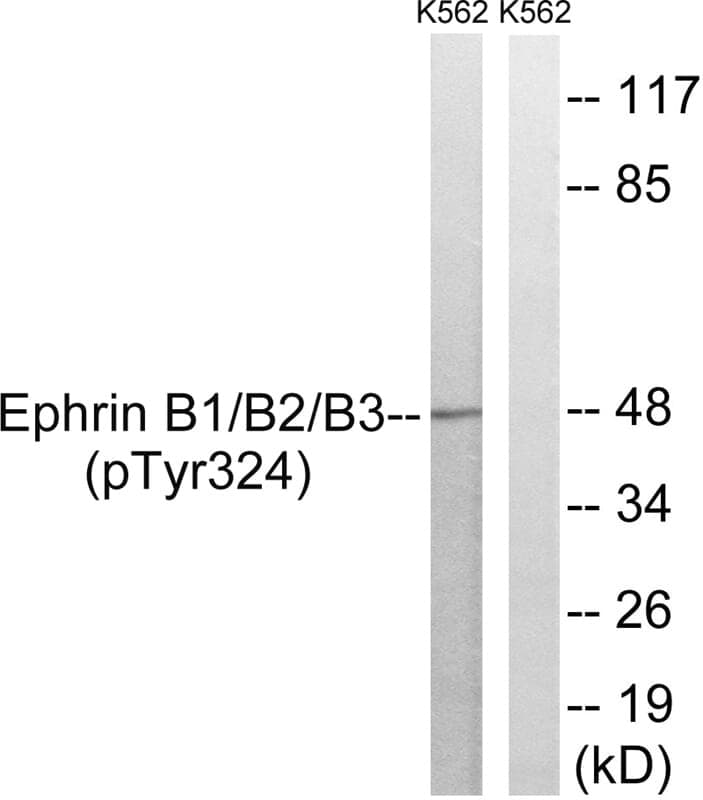 Anti-Ephrin B1 / B2 / B3 (Phospho-Tyr324) Antibody