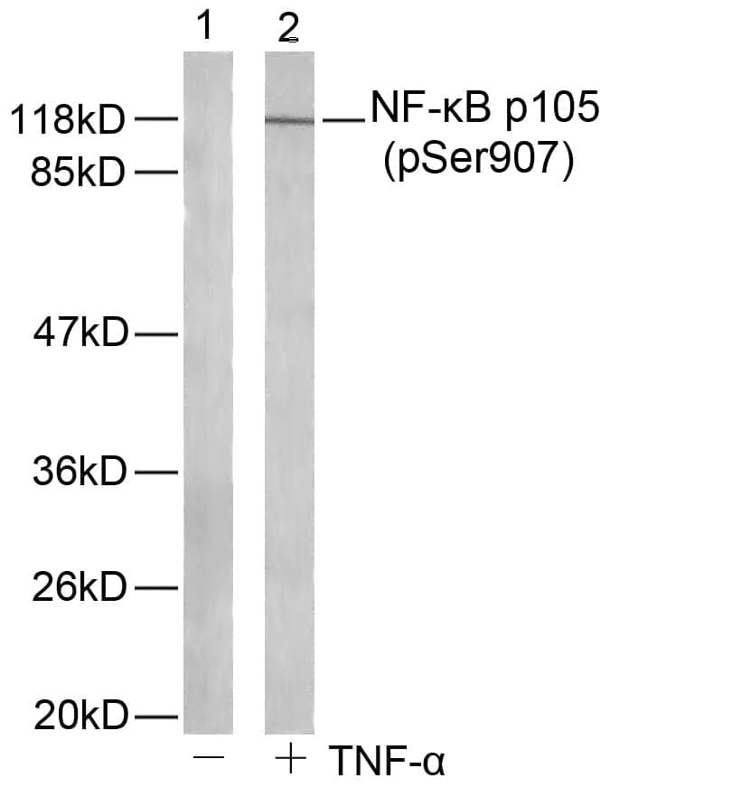 Anti-NFκB-p105 (Phospho-Ser907) Antibody