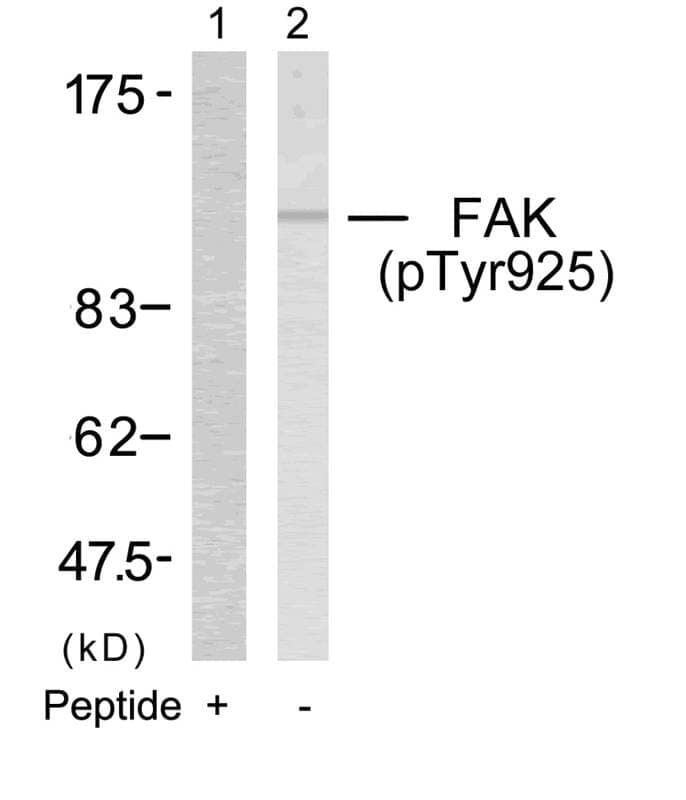 Anti-FAK (Phospho-Tyr925) Antibody