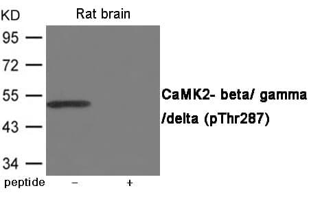 Anti-CaMK2- beta / gamma / delta (Phospho-Thr287) Antibody
