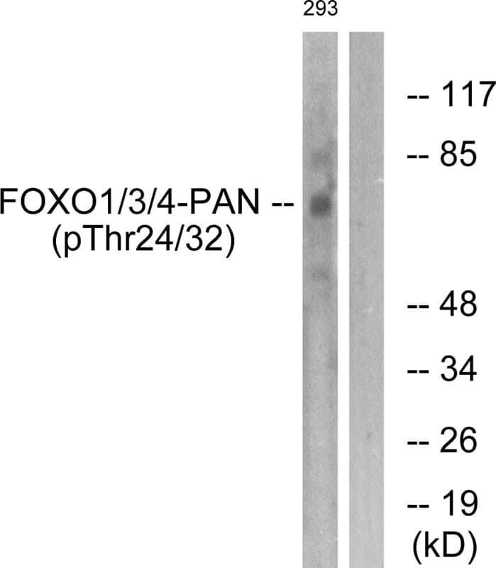 Anti-FOXO1 / 3 / 4-pan (Phospho-Thr24 / 32) Antibody