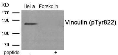 Anti-Vinculin (Phospho-Tyr822) Antibody