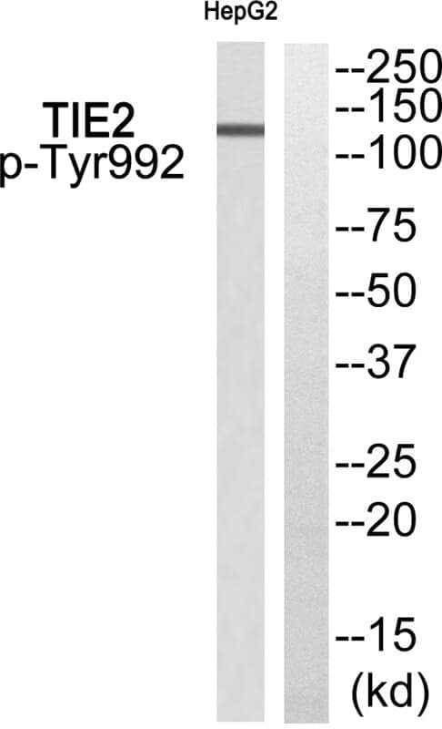 Anti-TIE2 (Phospho-Tyr992) Antibody