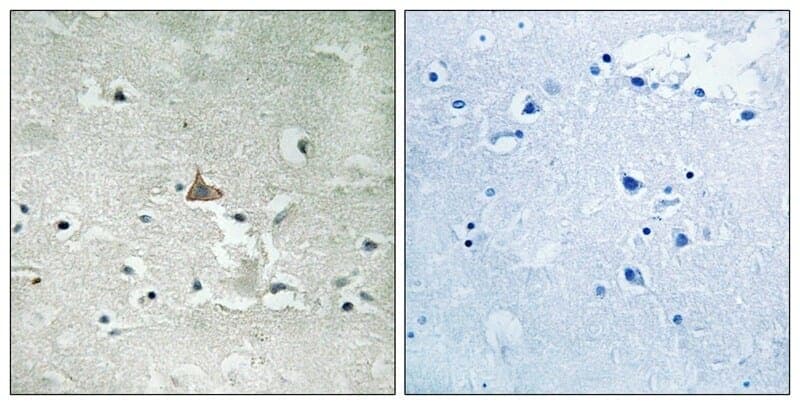 Anti-Trk B (Phospho-Tyr706 / Tyr707) Antibody