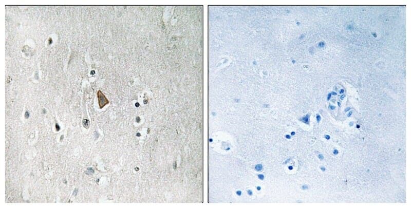 Anti-IGF1R (Phospho-Tyr1346) Antibody