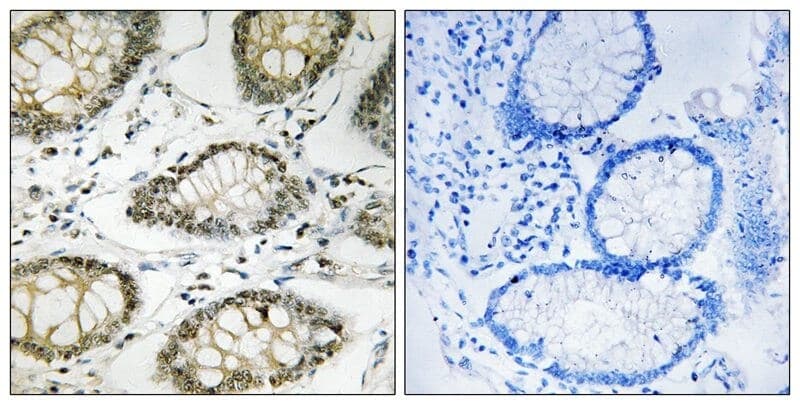 Anti-ATR (Phospho-Ser428) Antibody