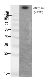 Anti-CBP (Acetyl-Lys1535) Antibody
