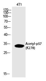 Anti-p57 (Acetyl-Lys278) Antibody