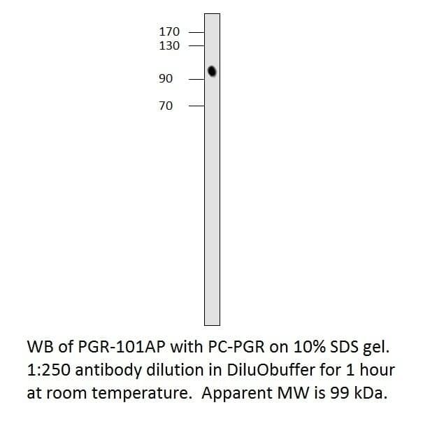 Anti-Progesterone Receptor Antibody