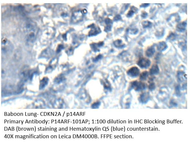 Anti-CDKN2A / p14ARF Antibody