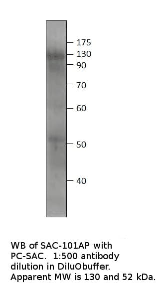 Anti-Soluble Adenylate Cyclase 1 Antibody