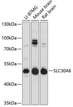 Anti-SLC30A6 Antibody