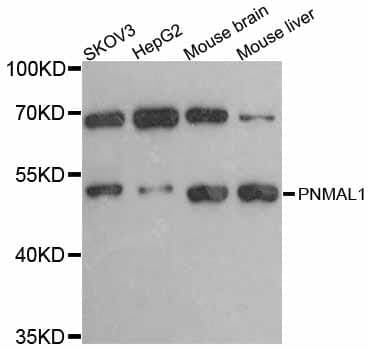 Anti-PNMAL1 Antibody