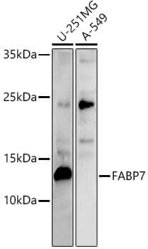 Anti-FABP7 Antibody