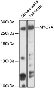 Anti-MYO7A Antibody