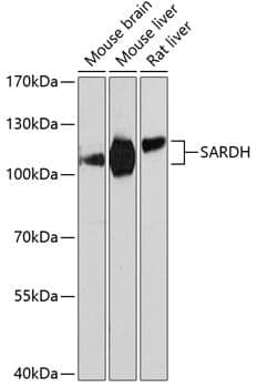 Anti-SARDH Antibody