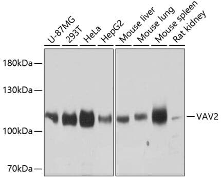 Anti-VAV2 Antibody