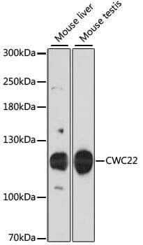 Anti-CWC22 Antibody