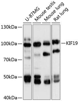 Anti-KIF19 Antibody