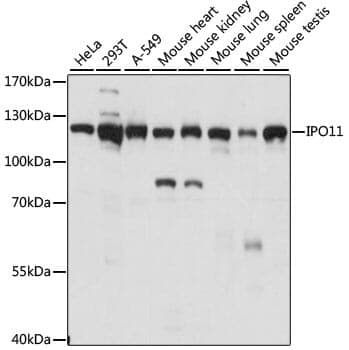 Anti-IPO11 Antibody