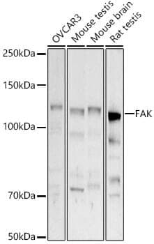 Anti-PTK2 Antibody