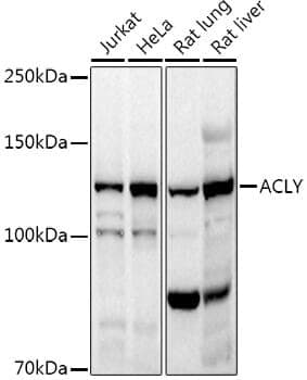 Anti-ACLY Antibody