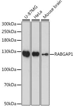 Anti-RABGAP1 Antibody