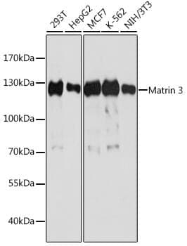 Anti-MATR3 Antibody