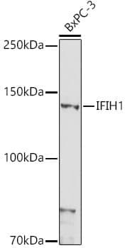 Anti-IFIH1 Antibody