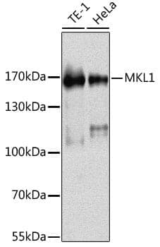 Anti-MKL1 Antibody