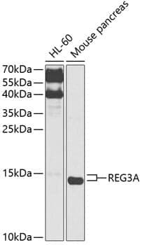 Anti-REG3A Antibody
