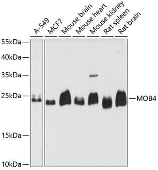 Anti-MOB4 Antibody