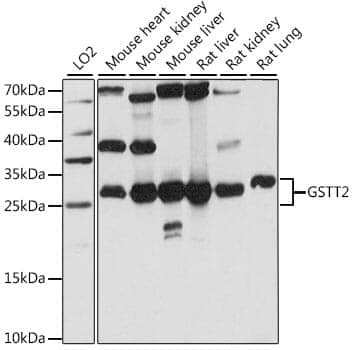 Anti-GSTT2 Antibody