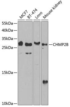 Anti-CHMP2B Antibody