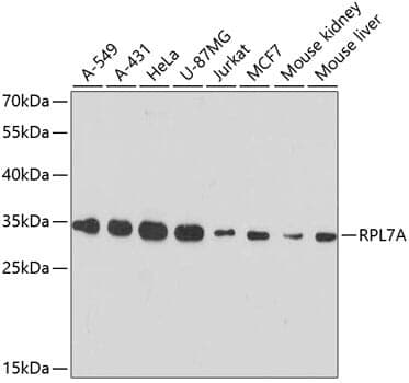 Anti-RPL7A Antibody