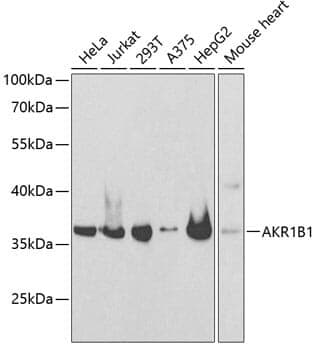 Anti-AKR1B1 Antibody