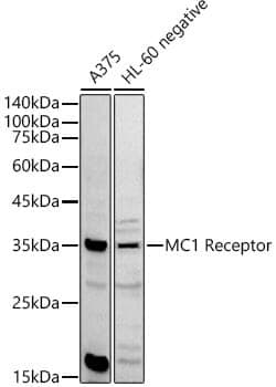Anti-MC1R Antibody