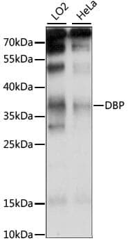 Anti-DBP Antibody