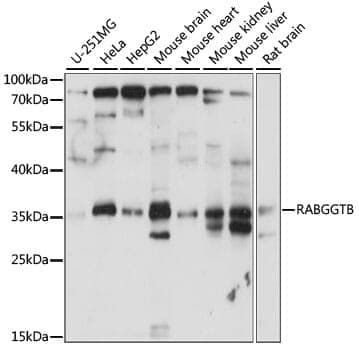 Anti-RABGGTB Antibody